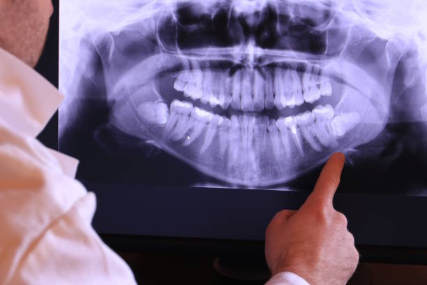 Best Emergency TMJ Treatment in Red Lick, TX