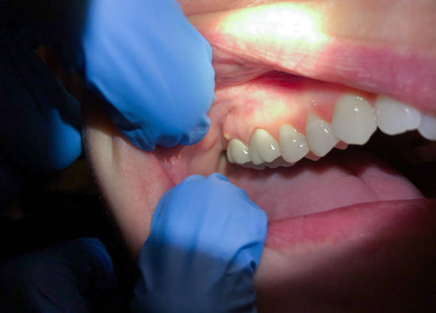 Best 24-Hour Emergency Dentist in Red Lick, TX