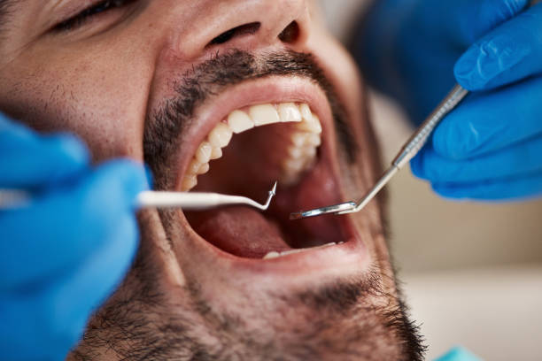 Best Emergency Treatment for Dental Infections or Abscesses in Red Lick, TX